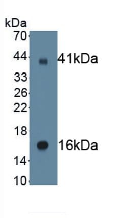 Invitrogen SCNN1G Monoclonal Antibody (C1), Invitrogen 100 &mu;L | Buy Online | Invitrogen&trade; | Fisher Scientific