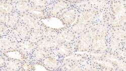 Invitrogen FIBB Monoclonal Antibody (C1), Invitrogen 20 &mu;L | Buy Online | Invitrogen&trade; | Fisher Scientific