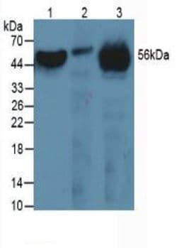 FIBB Monoclonal Antibody (C1), Invitrogen:Antibodies:Primary Antibodies