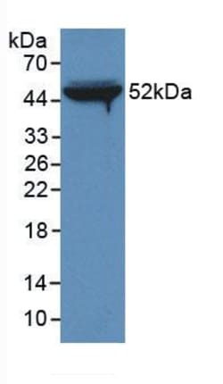 Invitrogen FIBB Monoclonal Antibody (C1), Invitrogen 20 &mu;L | Buy Online | Invitrogen&trade; | Fisher Scientific