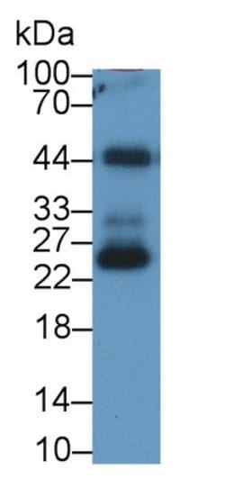 Invitrogen Ferritin Light Chain Monoclonal Antibody (H19), Invitrogen:Antibodies:Primary