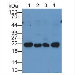 Invitrogen Ferritin Heavy Chain Monoclonal Antibody (D4), Invitrogen 20