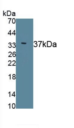 Invitrogen ERLIN2 Monoclonal Antibody (C2), Invitrogen 100 &mu;L; Unconjugated:Antibodies,