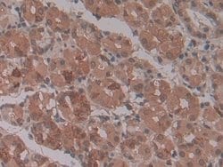 ENPP2 Monoclonal Antibody (C4), Invitrogen:Antibodies:Primary Antibodies