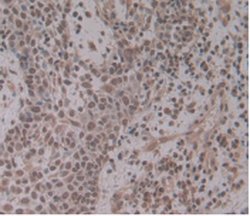 ENPP2 Monoclonal Antibody (C4), Invitrogen:Antibodies:Primary Antibodies
