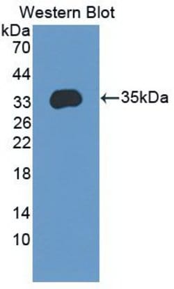 ENPP2 Monoclonal Antibody (C4), Invitrogen:Antibodies:Primary Antibodies