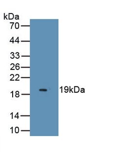 Invitrogen Endocan Monoclonal Antibody (C7), Invitrogen 100 &mu;L; Unconjugated:Antibodies,
