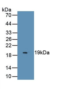 Endocan Monoclonal Antibody (C7), Invitrogen 20 &mu;L; Unconjugated:Antibodies,