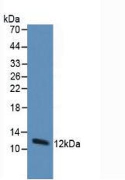 Invitrogen Thioredoxin 1 Monoclonal Antibody (3#), Invitrogen 20 &mu;L | Buy Online | Invitrogen&trade; | Fisher Scientific