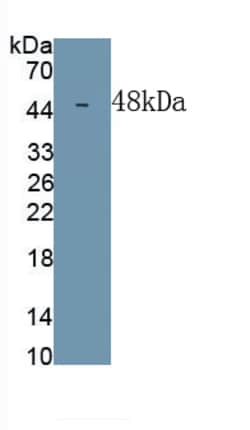 Invitrogen DPEP1 Monoclonal Antibody (C1), Invitrogen 100 &mu;L; Unconjugated:Antibodies,