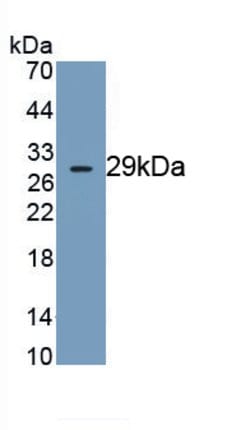 Invitrogen DNAH11 Monoclonal Antibody (C5), Invitrogen:Antibodies:Primary