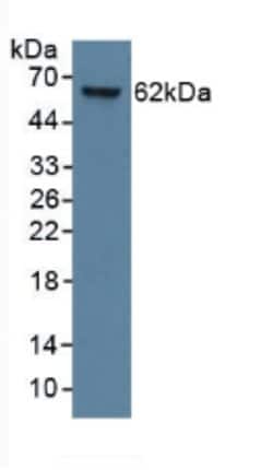 KRT9 Monoclonal Antibody (C7), Invitrogen:Antibodies:Primary Antibodies