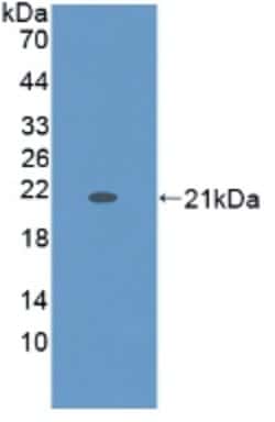 KRT9 Monoclonal Antibody (C7), Invitrogen:Antibodies:Primary Antibodies