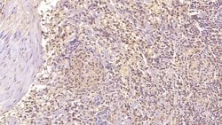 Invitrogen Factor D Monoclonal Antibody (C1), Invitrogen 100 &mu;L; Unconjugated:Antibodies,
