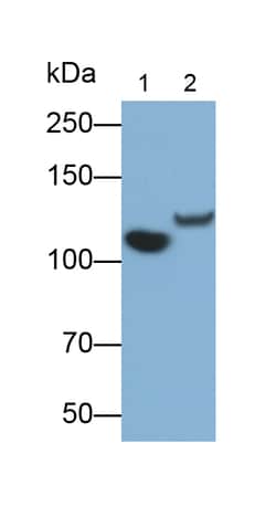 Invitrogen Complement C5a Monoclonal Antibody (D2), Invitrogen 100 &mu;L | Buy Online | Invitrogen&trade; | Fisher Scientific