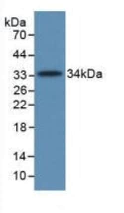 Invitrogen Complement C5a Monoclonal Antibody (D2), Invitrogen 100 &mu;L | Buy Online | Invitrogen&trade; | Fisher Scientific