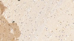 Invitrogen Procollagen I N-Peptide Monoclonal Antibody (H20), Invitrogen:Antibodies:Primary