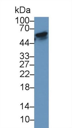 Invitrogen RANK (CD265) Monoclonal Antibody (D13), Invitrogen:Antibodies:Primary