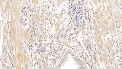 CD138 (Syndecan-1) Monoclonal Antibody (C3), Invitrogen:Antibodies:Primary