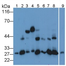 Invitrogen Cathepsin K Monoclonal Antibody (C1), Invitrogen 20 &mu;L; Unconjugated:Antibodies,