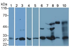 Invitrogen Cathepsin K Monoclonal Antibody (C1), Invitrogen 20 &mu;L; Unconjugated:Antibodies,