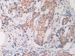 Cathelicidin Monoclonal Antibody (C1), Invitrogen:Antibodies:Primary Antibodies