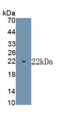 Invitrogen MYH7 Monoclonal Antibody (C1), Invitrogen 100 &mu;L; Unconjugated:Antibodies,