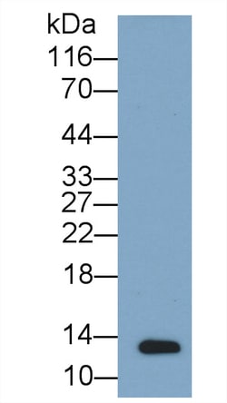 Invitrogen Osteocalcin Monoclonal Antibody (J10), Invitrogen 20 &mu;L | Buy Online | Invitrogen&trade; | Fisher Scientific