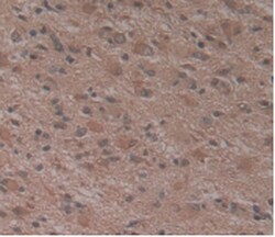 Invitrogen Atrophin 1 Monoclonal Antibody (C1), Invitrogen 20 &mu;L; Unconjugated:Antibodies,