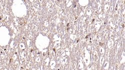 Invitrogen ASPH Monoclonal Antibody (C13), Invitrogen 20 &mu;L; Unconjugated:Antibodies,