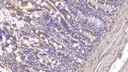 Invitrogen ASPH Monoclonal Antibody (C13), Invitrogen 20 &mu;L; Unconjugated:Antibodies,