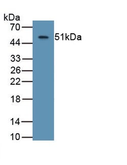 Invitrogen ASPH Monoclonal Antibody (C13), Invitrogen 20 &mu;L; Unconjugated:Antibodies,