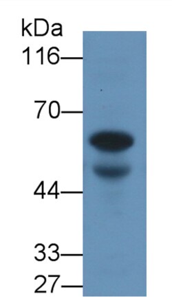 Invitrogen AMH Monoclonal Antibody (H9), Invitrogen 100 &mu;L | Buy Online | Invitrogen&trade; | Fisher Scientific