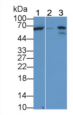 Invitrogen ALPL Monoclonal Antibody (D1), Invitrogen 20 &mu;L; Unconjugated:Antibodies,