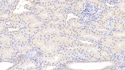 ALOX15 Monoclonal Antibody (6#), Invitrogen:Antibodies:Primary Antibodies