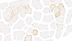 ALOX15 Monoclonal Antibody (6#), Invitrogen:Antibodies:Primary Antibodies