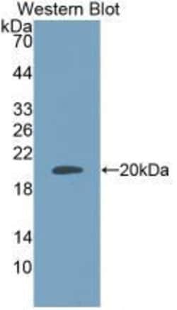 Invitrogen Adrenomedullin Monoclonal Antibody (C1), Invitrogen 100 &mu;L;