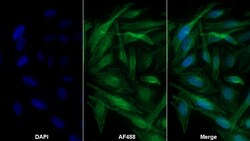 Invitrogen A1BG Monoclonal Antibody (C1), Invitrogen 100 &mu;L | Buy Online | Invitrogen&trade; | Fisher Scientific