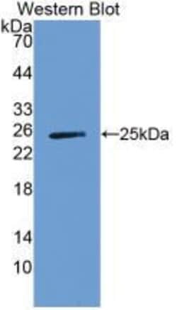 Invitrogen A1BG Monoclonal Antibody (C1), Invitrogen:Anticorps:Anticorps