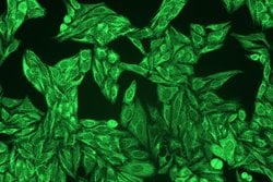 Invitrogen Cytokeratin 4/5/6/8/10/13/18 Monoclonal Antibody (C-11) 100