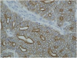 Invitrogen Cytokeratin 4/5/6/8/10/13/18 Monoclonal Antibody (C-11) 100