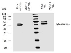 Invitrogen Cytokeratin 4/5/6/8/10/13/18 Monoclonal Antibody (C-11) 100