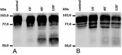 Invitrogen CD18 Monoclonal Antibody (MEM-148) 100 &mu;g; Unconjugated:Antibodies,
