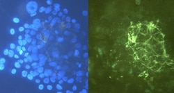 Invitrogen Tenascin C Monoclonal Antibody (T2H5) 100 &mu;g; Unconjugated:Antibodies,