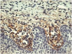 Invitrogen Tenascin C Monoclonal Antibody (T2H5) 100 &mu;g; Unconjugated:Antibodies,