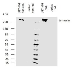 Invitrogen Tenascin C Monoclonal Antibody (T2H5) 100 &mu;g; Unconjugated:Antibodies,