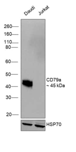 Invitrogen CD79a Monoclonal Antibody (HM57) 100 &mu;g | Buy Online | Invitrogen&trade; | Fisher Scientific