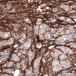 Invitrogen Periostin Monoclonal Antibody (CL12087) 100 &mu;L; Unconjugated:Antibodies,