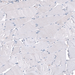 Invitrogen Periostin Monoclonal Antibody (CL12087) 100 &mu;L; Unconjugated:Antibodies,