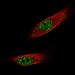 FOXM1 Monoclonal Antibody (CL12131):Antibodies, Monoclonal